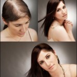 Hair Loss Control Therapy