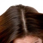 A healthy scalp- Tips from Sunsilk hair Expert