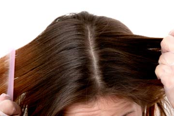 A healthy scalp- Tips from Sunsilk hair Expert
