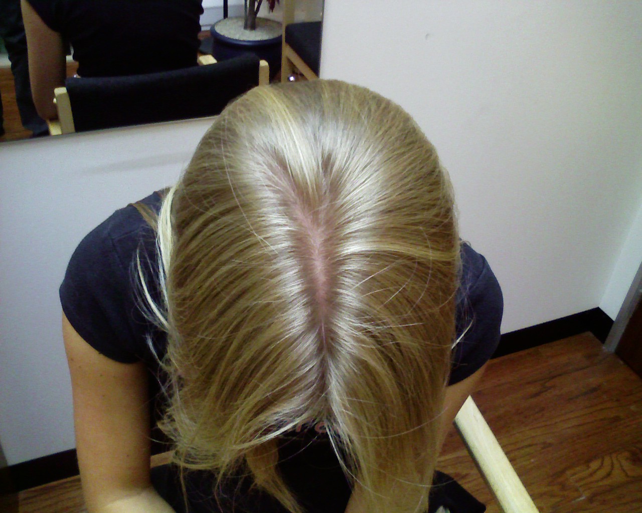 Dry Scalp Is The Reason For Hair Loss Rewaj Women Lifestyle Dry Scalp Is The Reason For Hair Loss Rewaj Women Lifestyle