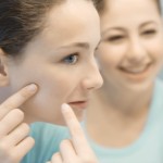 Newborn Acne